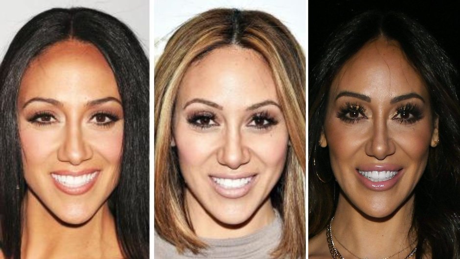 'RHONJ' Star Melissa Gorga Is Open About Her Plastic Surgery — But She Didn't Get 4 Nose Jobs