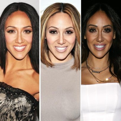 'RHONJ' Star Melissa Gorga Is Open About Her Plastic Surgery — But She Didn't Get 4 Nose Jobs