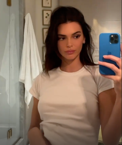 Kendall Jenner Lip Filler Rumors