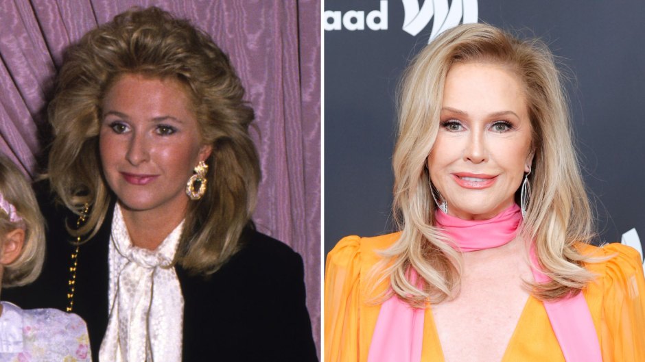 Has Kathy Hilton Gotten Plastic Surgery? See Her Transformation