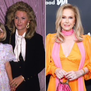 Has Kathy Hilton Gotten Plastic Surgery? See Her Transformation