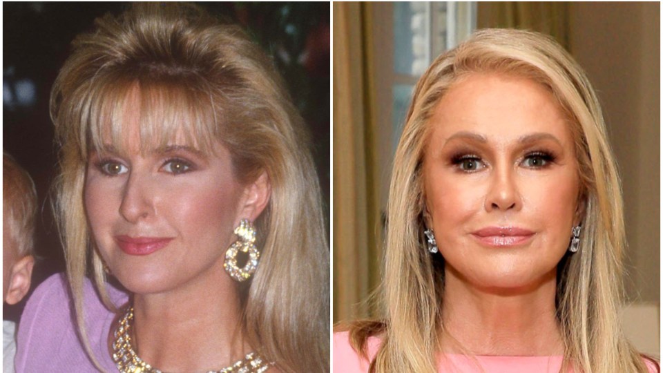 Has Kathy Hilton Gotten Plastic Surgery? See Her Transformation