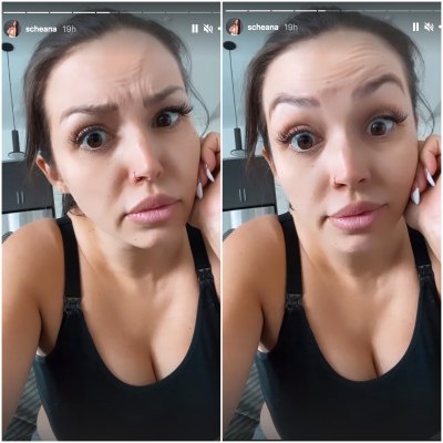 scheana-shay-botox-pregnancy