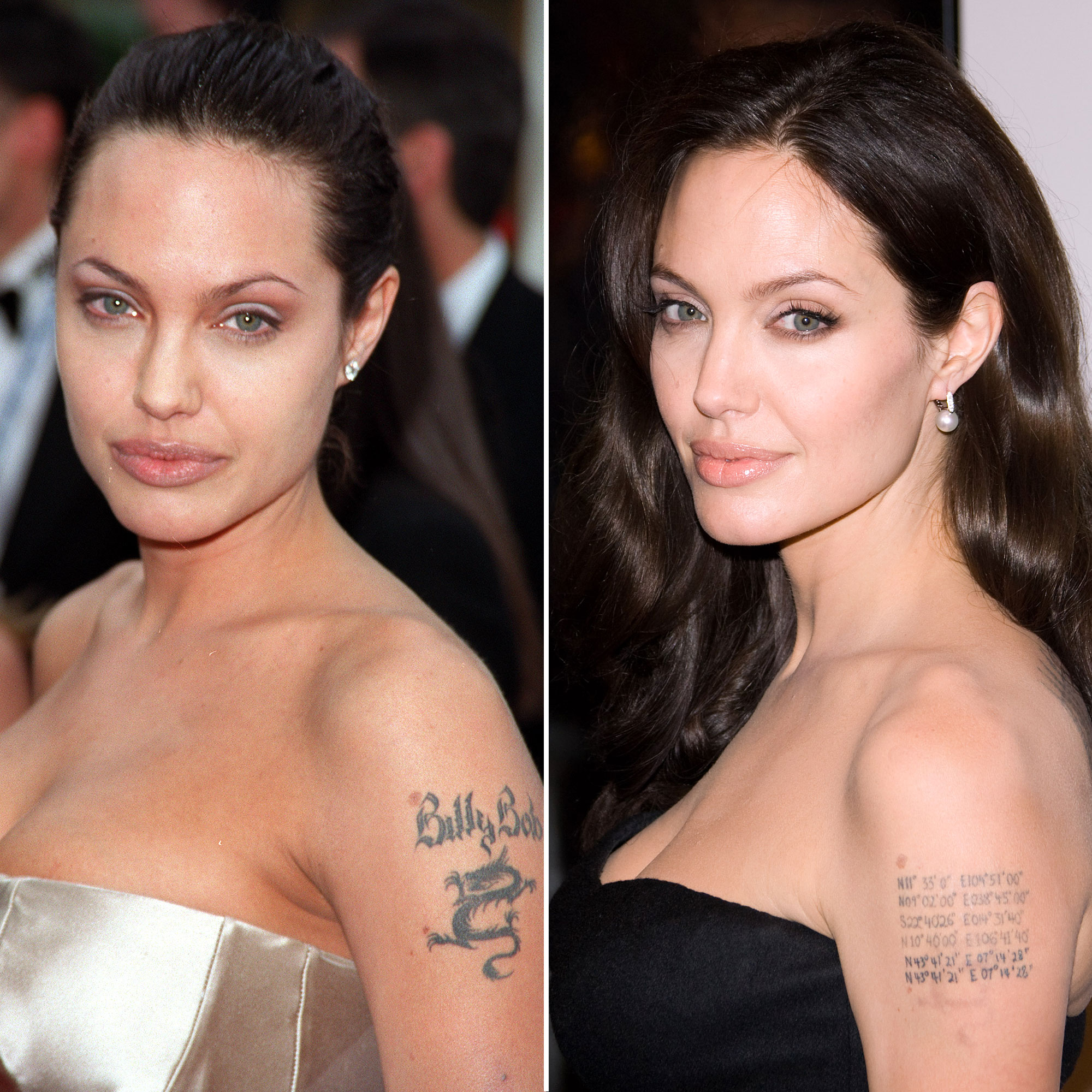 celebrity tattoo removal before and after .pe