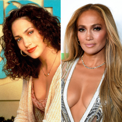 Did Jennifer Lopez Have Plastic Surgery? Photos Young and Now