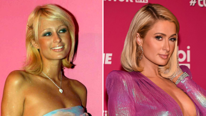 Did Paris Hilton Get Plastic Surgery? What the Heiress Had Done