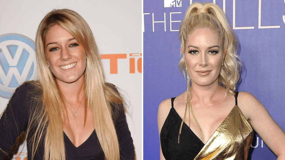 Heidi Montag Hairy Pussy - Heidi Montag Plastic Surgery: Photos of Her Before and After