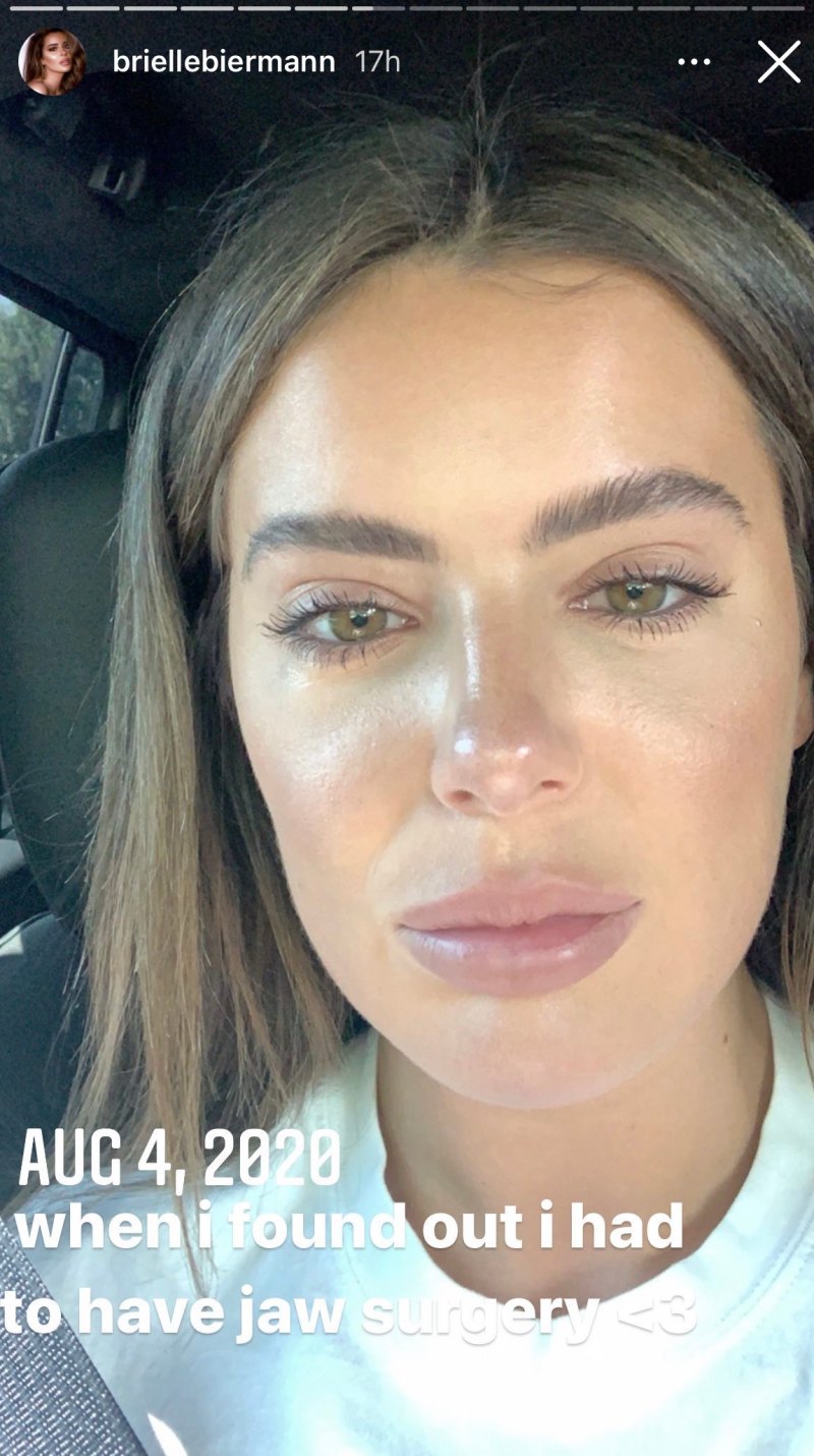 'Don't Be Tardy' Star Brielle Biermann Documents Double Jaw Surgery: Before and After Photos