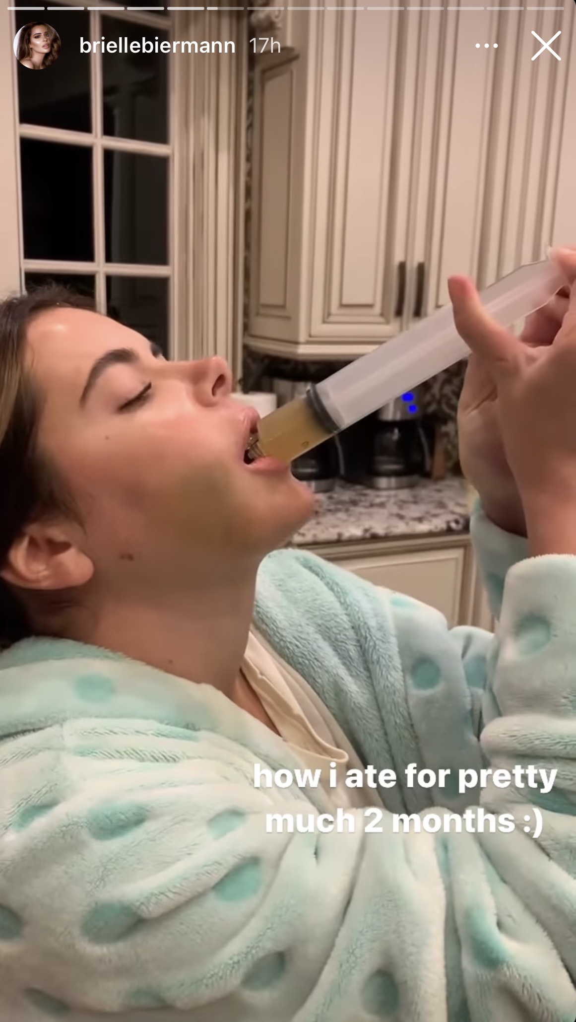 'Don't Be Tardy' Star Brielle Biermann Documents Double Jaw Surgery: Before and After Photos