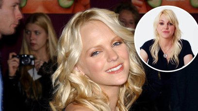 Anna Faris Transformation Plastic Surgery Photos