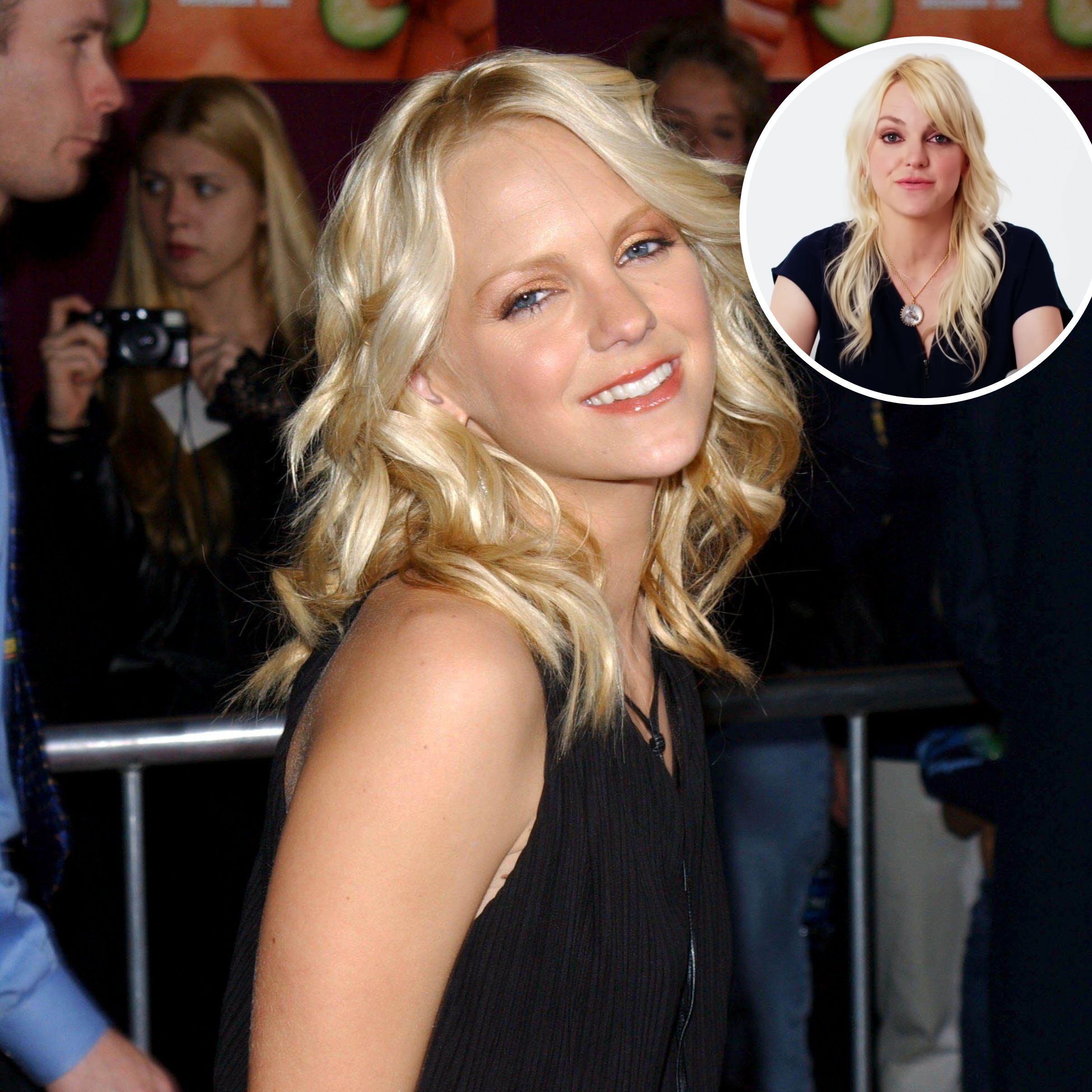 Anna Faris Plastic Surgery: Her Transformation Over the Years