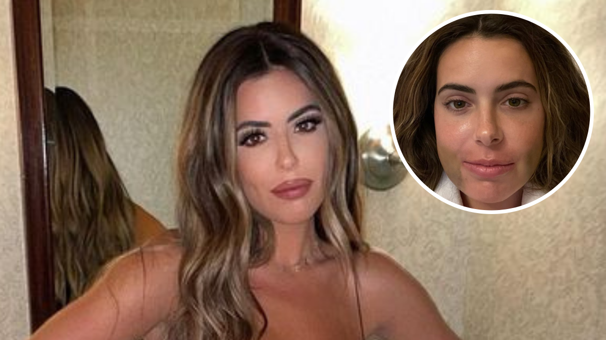 Brielle Biermann's Double Jaw Surgery: Before and After Photos