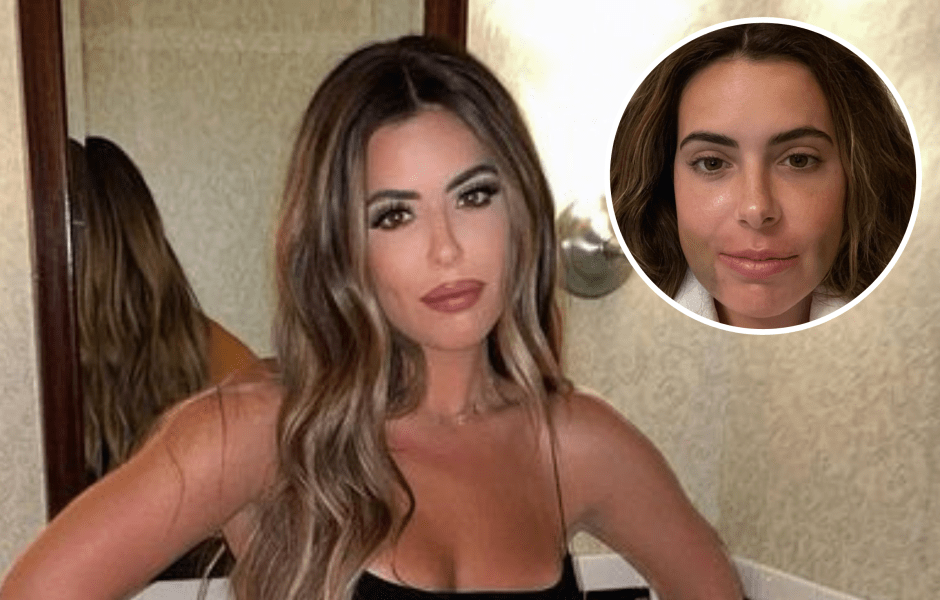 Brielle Biermann's Double Jaw Surgery: Before and After Photos