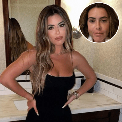 Brielle Biermann's Double Jaw Surgery: Before and After Photos