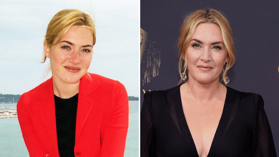 Did Kate Winslet Have Plastic Surgery? Transformation Photos