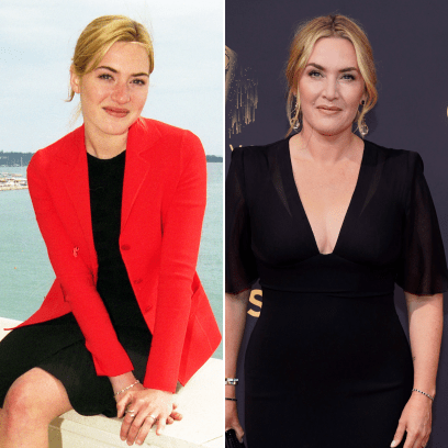 Did Kate Winslet Have Plastic Surgery? Transformation Photos