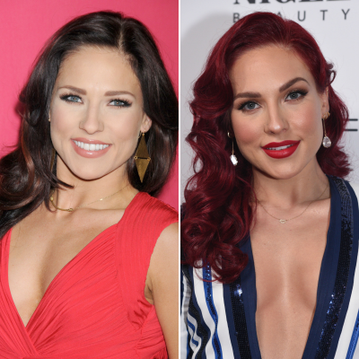 'Dancing With the Stars' Pros Who've Talked About Plastic Surgery Sharna Burgess