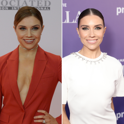 'Dancing With the Stars' Pros Who've Talked About Plastic Surgery Jenna Johnson