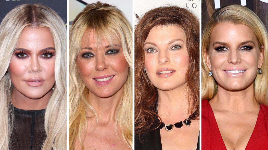 Celebs Who Have Admitted to Botched Plastic Surgery: Photos