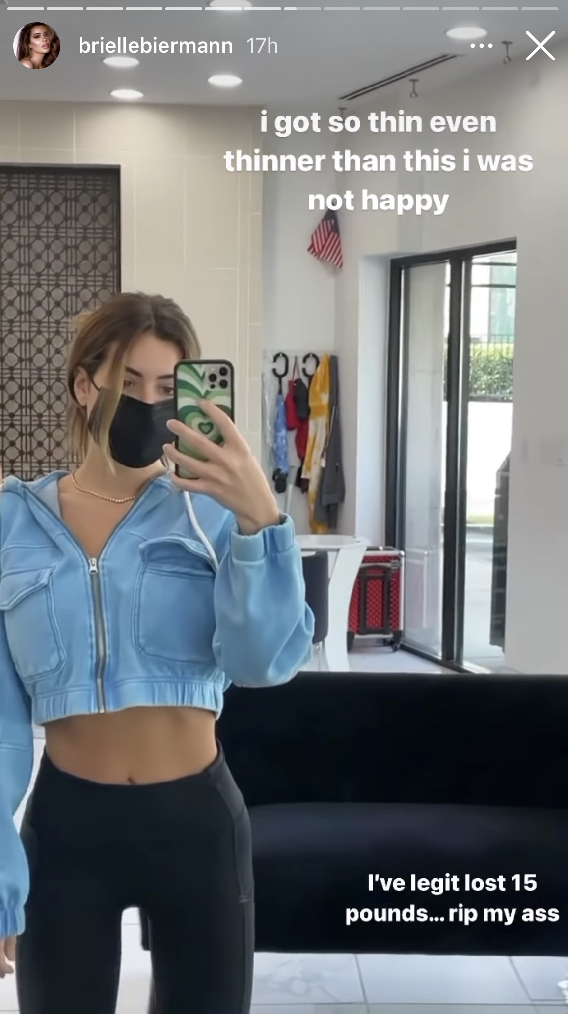 Brielle biermann jaw surgery photos01