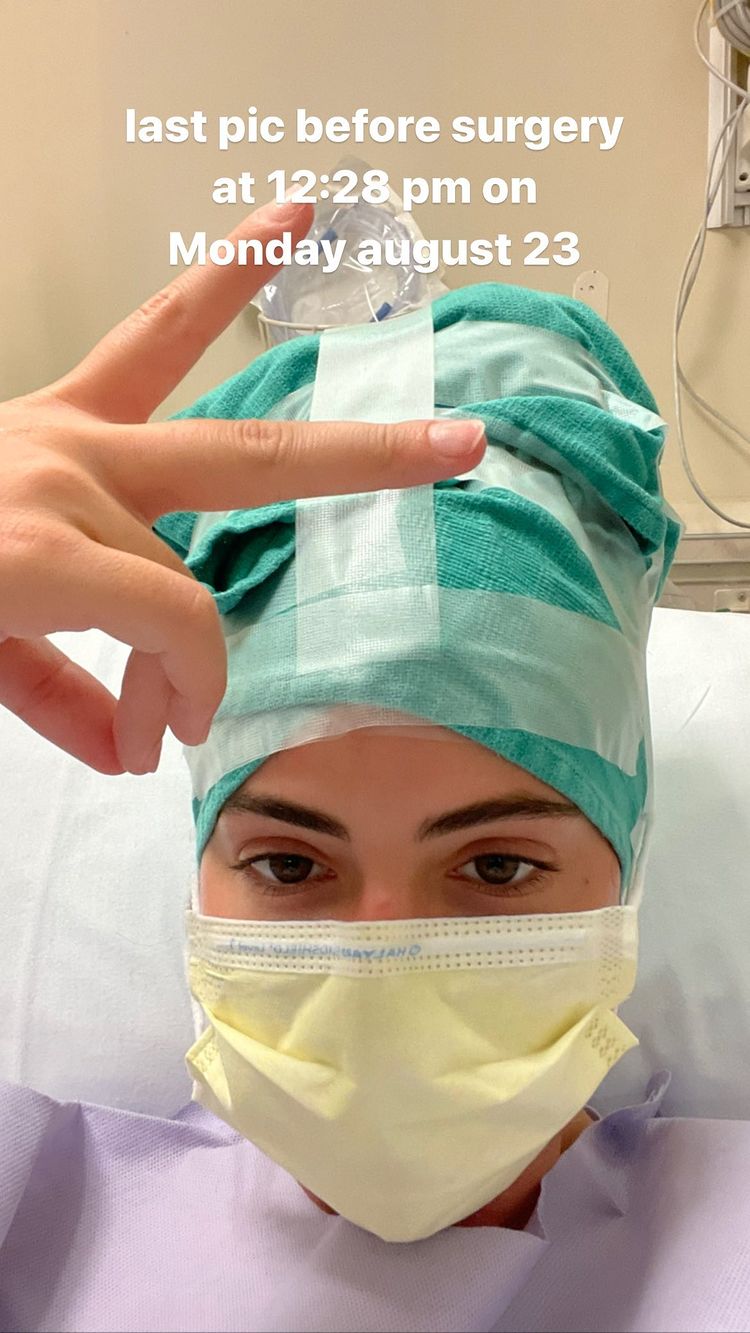 Brielle Biermann's Double Jaw Surgery: Before and After Photos 3