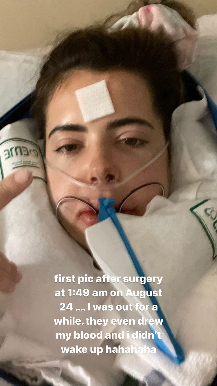 Brielle Biermann's Double Jaw Surgery: Before and After Photos 2