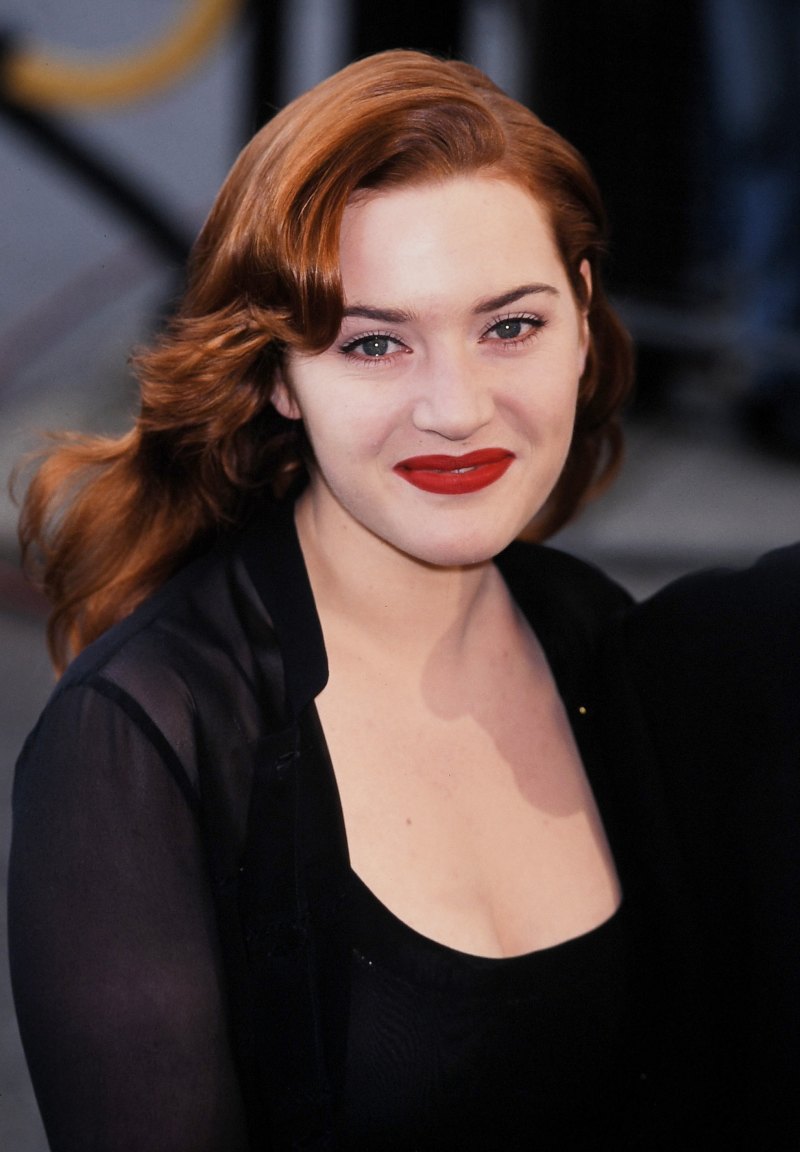 Did Kate Winslet Have Plastic Surgery? Transformation Photos 1997