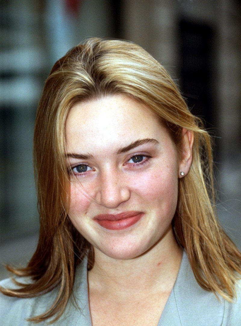 Did Kate Winslet Have Plastic Surgery? Transformation Photos 1993