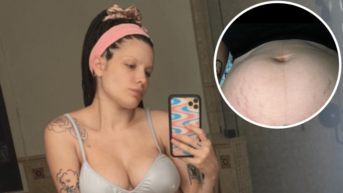 Halsey Shares an 'Important' Post About Their ‘Changing’ Postpartum Body: ‘I’m Really Tired’