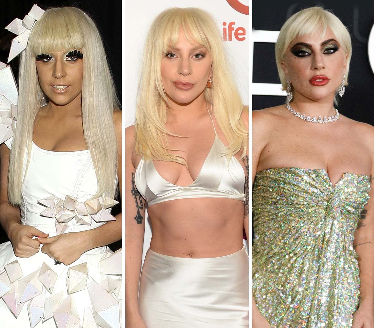 Did-Lady-Gaga-Get-Plastic-Surgery-Everyt