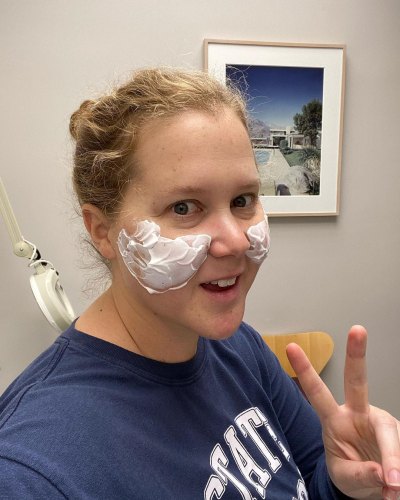 Amy Schumer Dissolves Fillers After Plastic Surgery Procedure: ' I Looked Like Malificent'