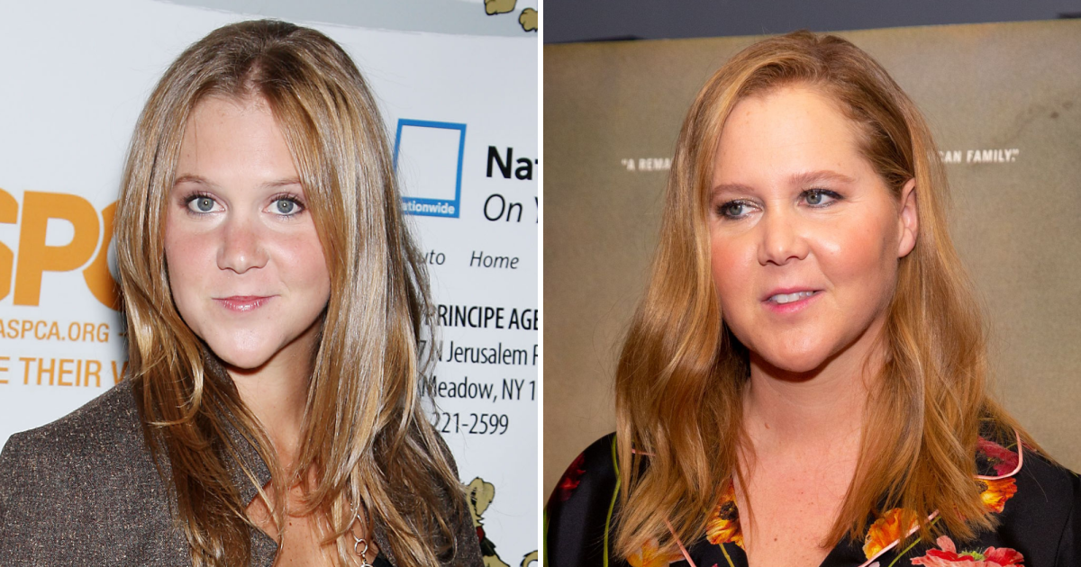 Amy Schumer Pussy Gif - Did Amy Schumer Get Plastic Surgery? Transformation Photos