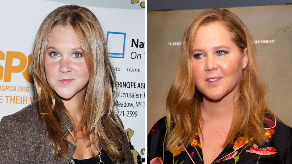 Amy Schumer Sex Real - Did Amy Schumer Get Plastic Surgery? Transformation Photos