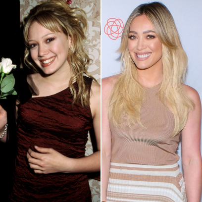 Did Hilary Duff Get Plastic Surgery? Before and After Photos