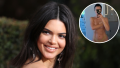 At the 2018 Golden Globe Awards, Kendall Jenner's acne and acne scars were fully visible under her makeup. “I was feeling good about myself, and then when people say mean things, I’m like, ‘I know I have a zit. I know I’m breaking out. You guys don’t have to keep pointing it out. I obviously see that, but let me live,’” the supermodel told Allure at the time.