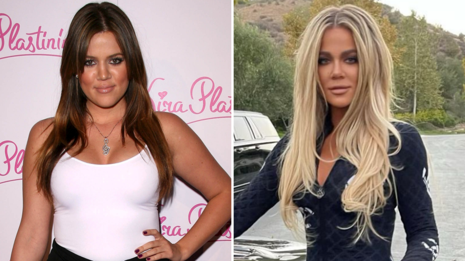 Khloe Kardashian’s Plastic Surgery From Botox to a Nose Job: See How Much She’s Changed