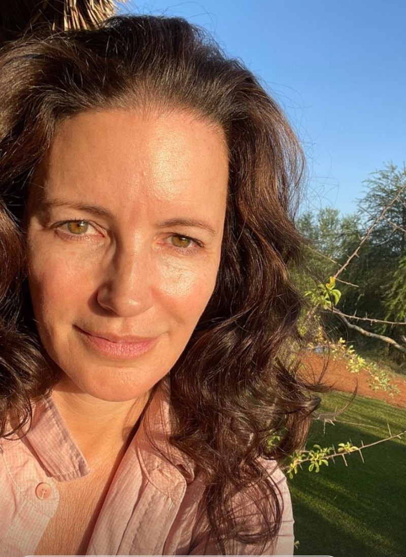 Kristin Davis Plastic Surgery