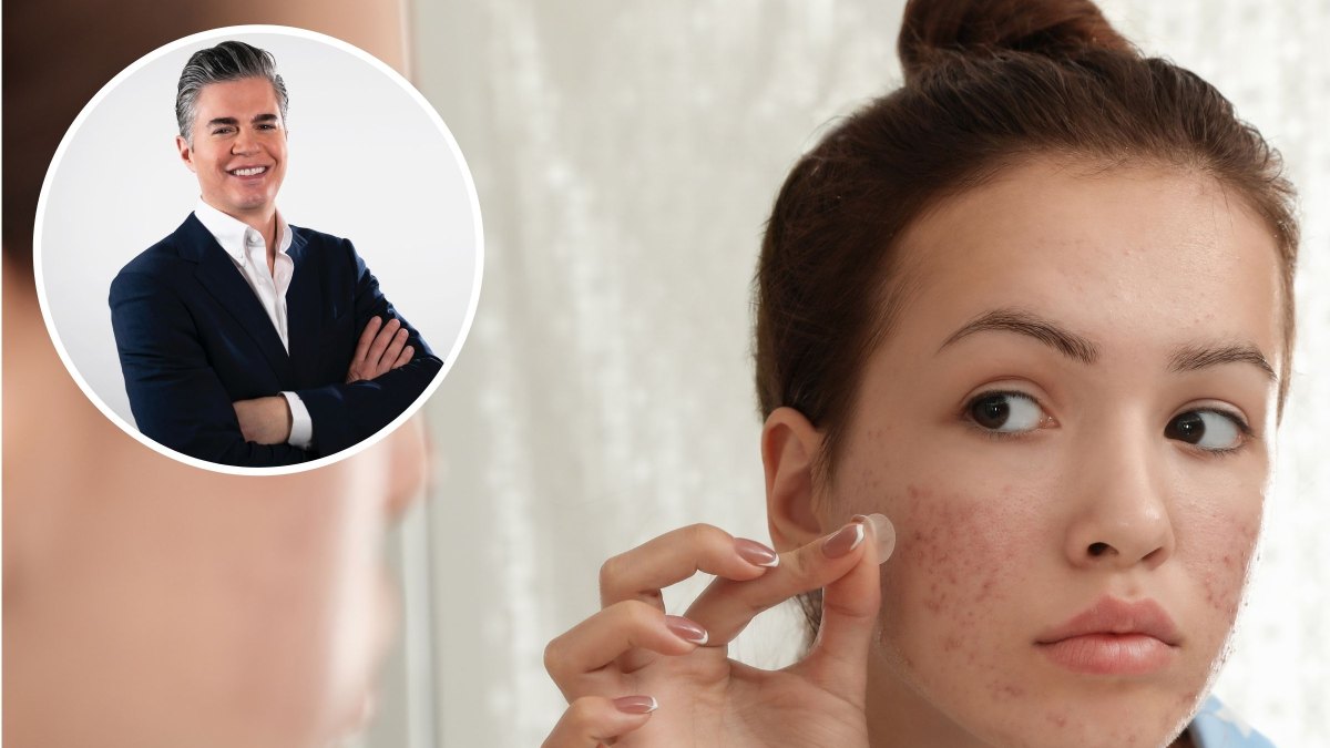 Skin Check-In With Dr. Will: Everything You Need to Know About Using Hydrocolloid Patches for Acne