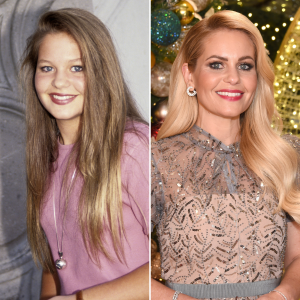 Did Candace Cameron Bure Get Plastic Surgery? Photos Then, Now