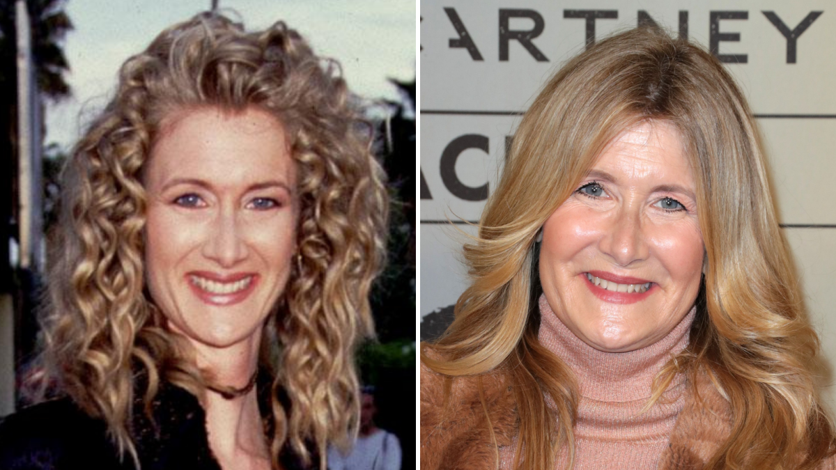 Did Laura Dern Get Plastic Surgery? The Actress' Transformation