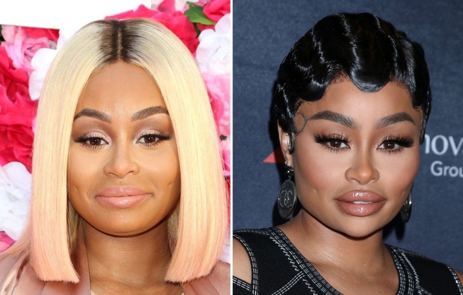 Black Chyna Always Looks Amazing With Or Without Plastic Surgery! Before and After Photos 