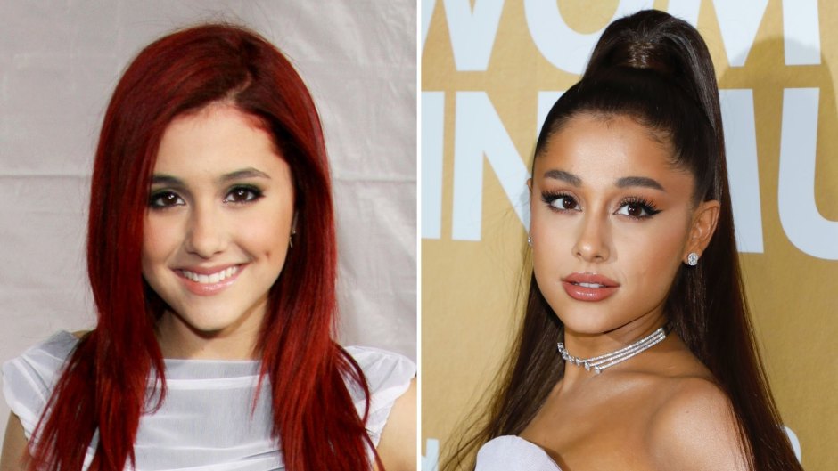 Did Ariana Grande Get Plastic Surgery? Her Transformation 