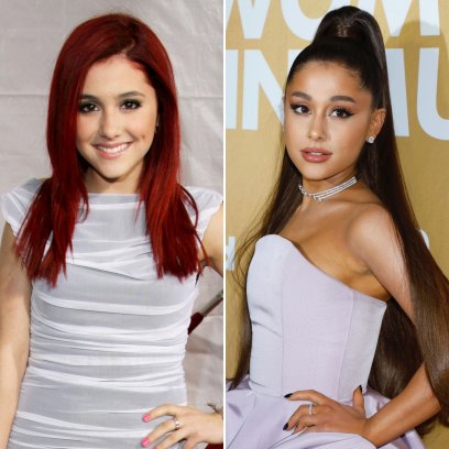 Did Ariana Grande Get Plastic Surgery? Her Transformation 