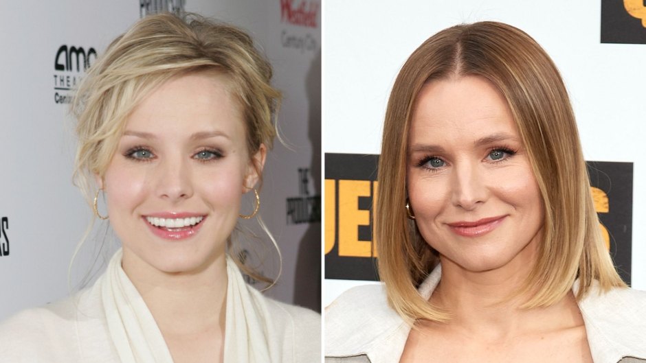 Did Kristen Bell Get Plastic Surgery? See Her Transformation From ‘Veronica Mars’ to Netflix Stardom