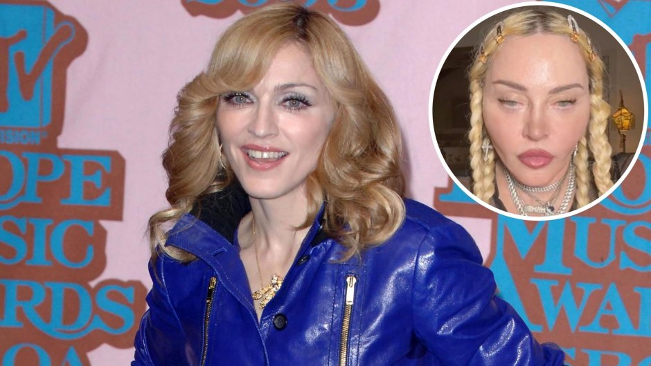 Material Girl! Madonna's Transformation From the '80s to Today Amid Plastic Surgery Rumors