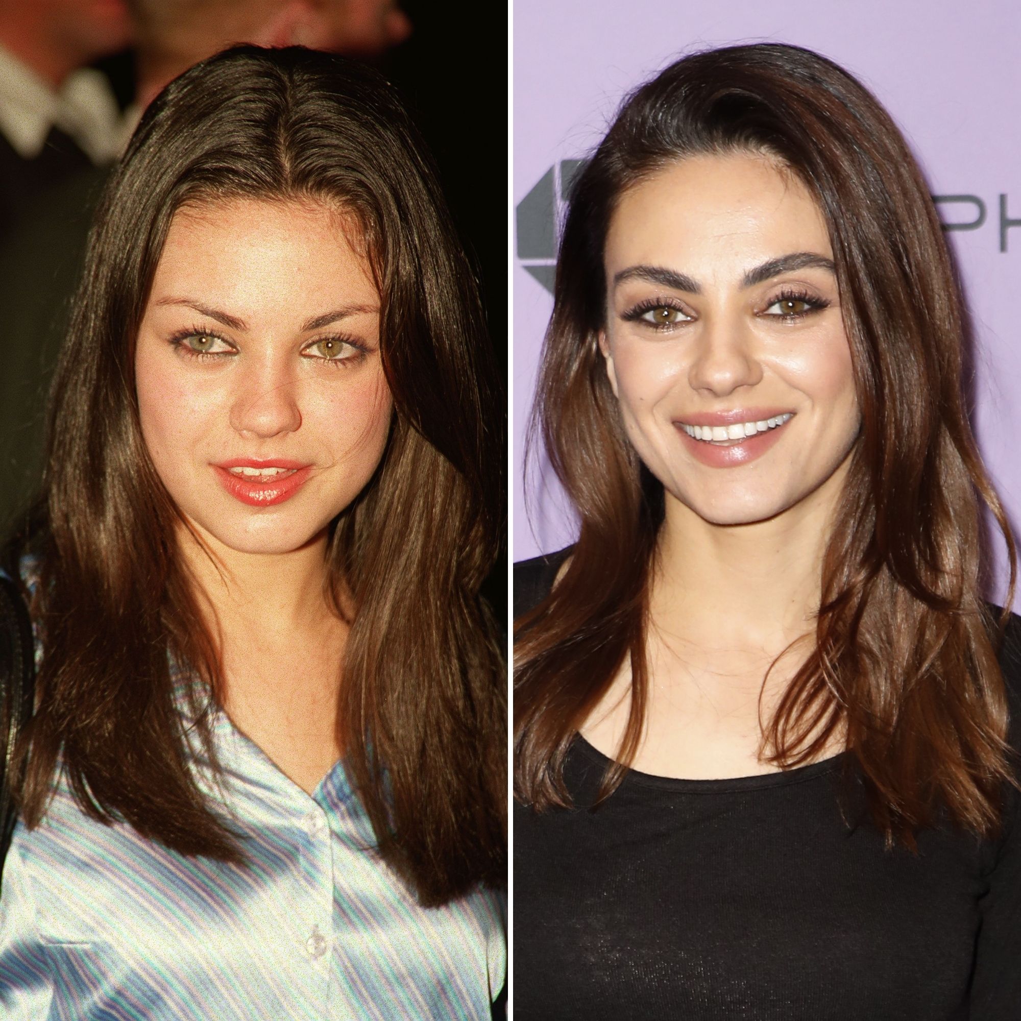 Mila Kunis Porn Galleries - Did Mila Kunis Get Plastic Surgery? Then and Now Photos