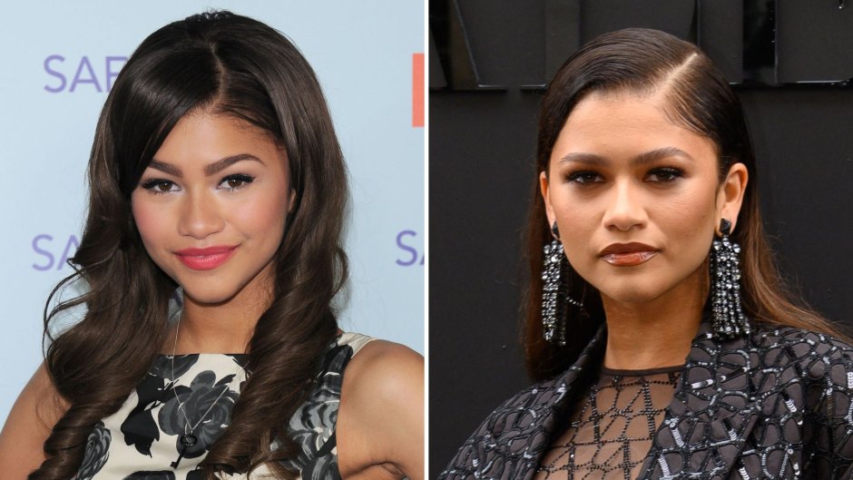 Did Zendaya Get Plastic Surgery? What She's Said About Nose Job Speculation and Past Edited Photos