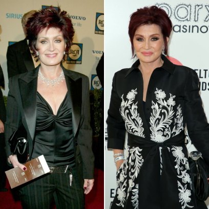 Did Sharon Osbourne Get Plastic Surgery? The Former Reality Star Recounts Past Procedures