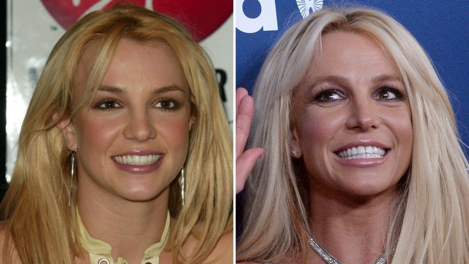 Britney Spears Admits She Considered Getting Plastic Surgery: See Photos of Her Transformation