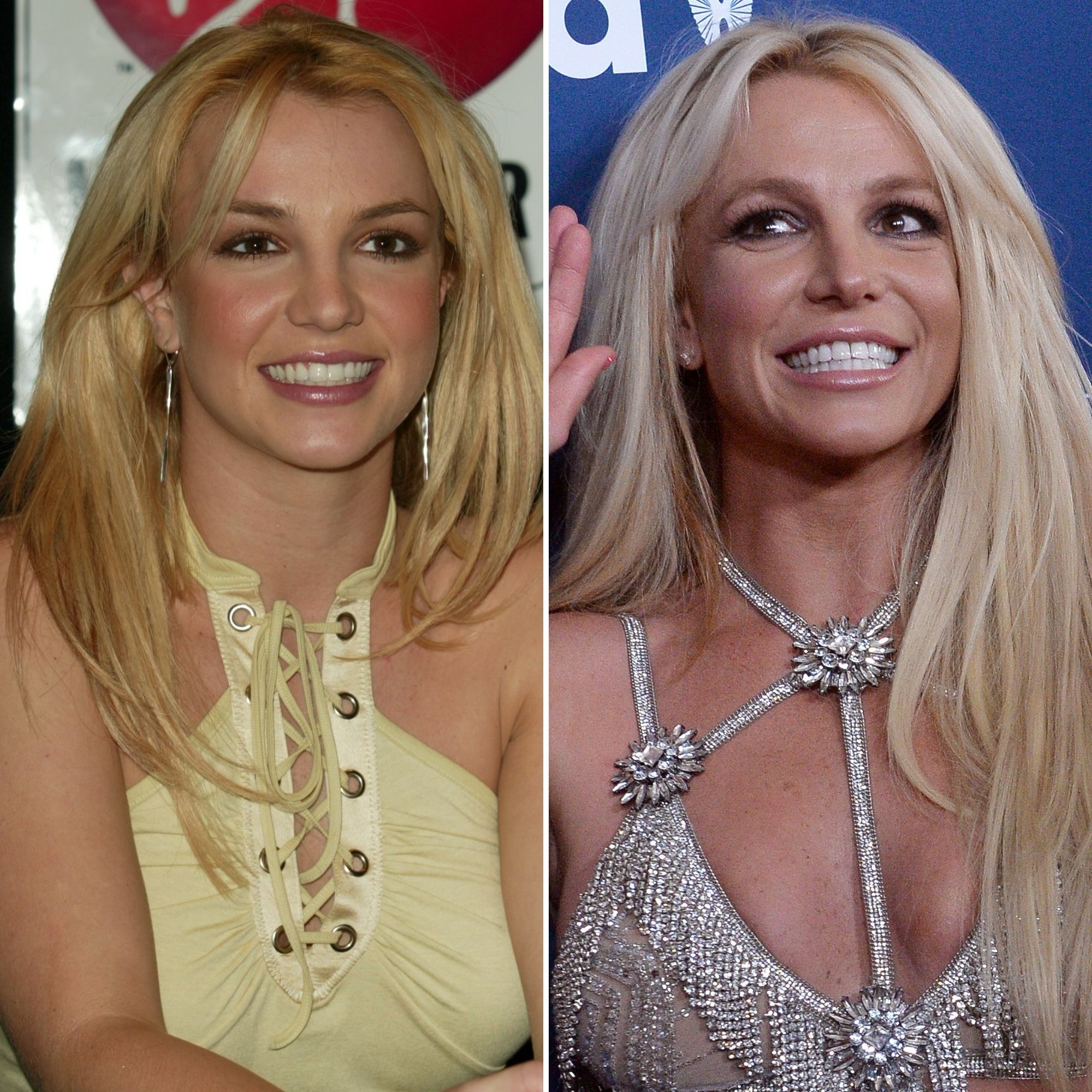 Did Britney Spears Get Plastic Surgery? Her Transformation Pictures